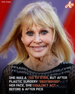 She Was a Hollywood Bombshell in the '70s, but After Plastic Surgery 'Destroyed' Her Face, She Could No Longer Act in Movies