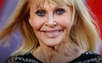 She Was a Hollywood Bombshell in the '70s, but After Plastic Surgery 'Destroyed' Her Face, She Could No Longer Act in Movies