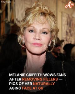 Melanie Griffith's Transformation - Her Journey with Fillers to Her Look Now at 67