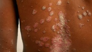 SERIOUS Diseases Diagnosed Via Skin Signals!