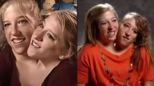 Where are conjoined twins and former reality TV stars Abby and Brittany Hensel now?