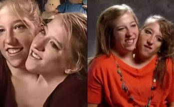 Where are conjoined twins and former reality TV stars Abby and Brittany Hensel now?