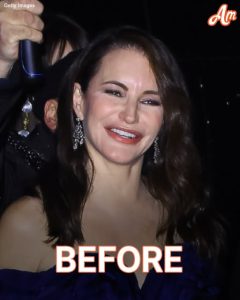 'Sex & the City' Star Kristin Davis, 59, Shared a Pic That Left Fans at a Loss for Words — See How Her Face Changed Over Time With and Without Fillers