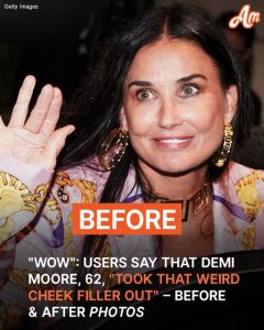 Users Say Demi Moore, 62, Had 'Fillers Removed' Based on Her Recent Public Appearance – Pics of the Transformation