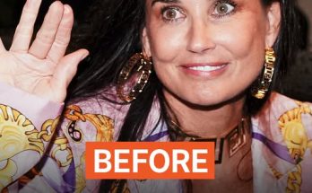 Users Say Demi Moore, 62, Had 'Fillers Removed' Based on Her Recent Public Appearance – Pics of the Transformation