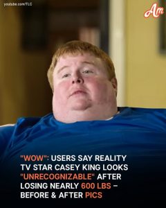 'Amazing Transformation': Users Amazed at How Reality Star Casey King Looks After Losing 600 Pounds – Pics Before & After