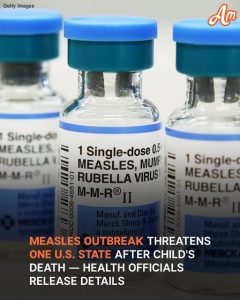 Measles Outbreak and Child's Death Reported in One U.S. State — Details