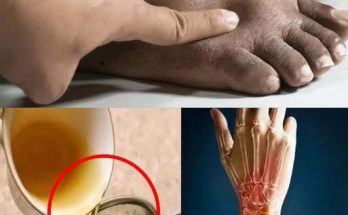 Simple and quick home remedies for swollen feet…