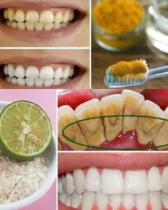 Whiten your teeth at home with this trick