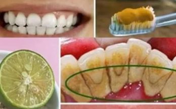 Whiten your teeth at home with this trick