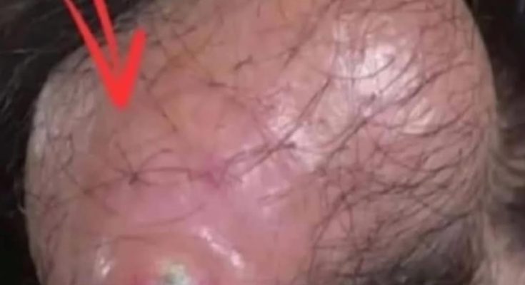 Why Your Pores Might Be the Real Reason You’re Still Breaking Out